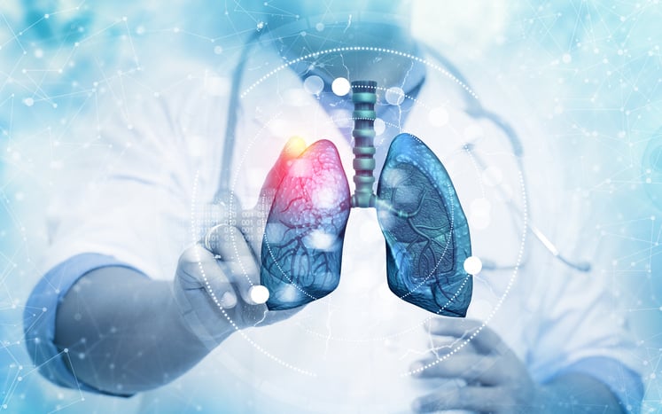 A doctor with a graphic representation of the lungs